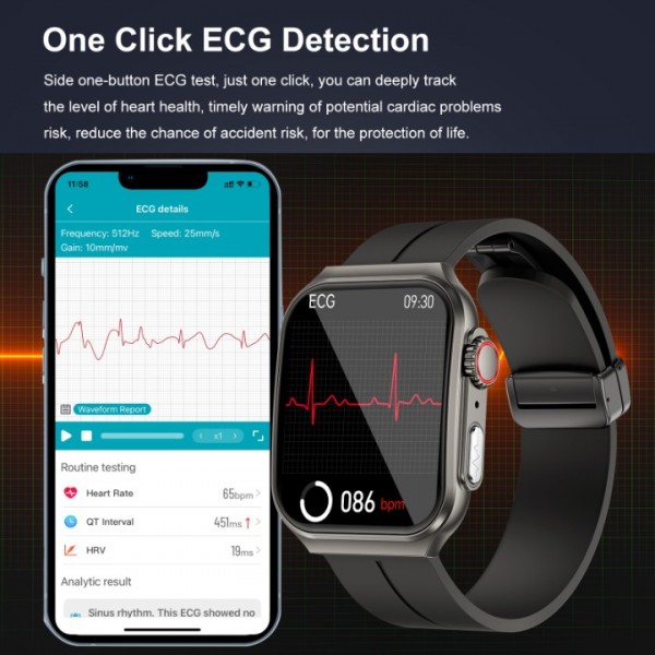 Marsyu Smartwatch, Blood glucose measurement, ECG, 24/7 SpO2, Heart rate monitor, Sleep monitor,1,96"Blood glucose meter with Bluetooth call, 150+ sport modes, Activity bracelet (Black)